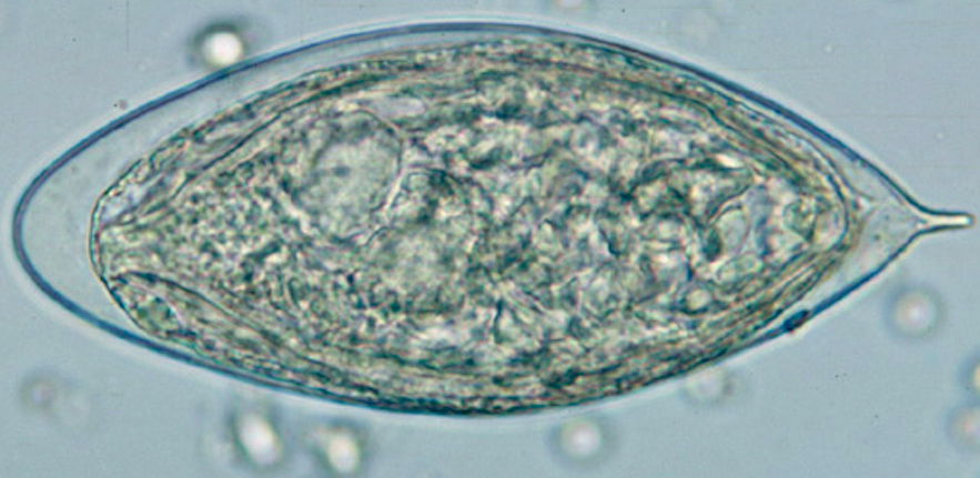 Schistosoma large