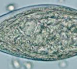  Schistosomiasis small